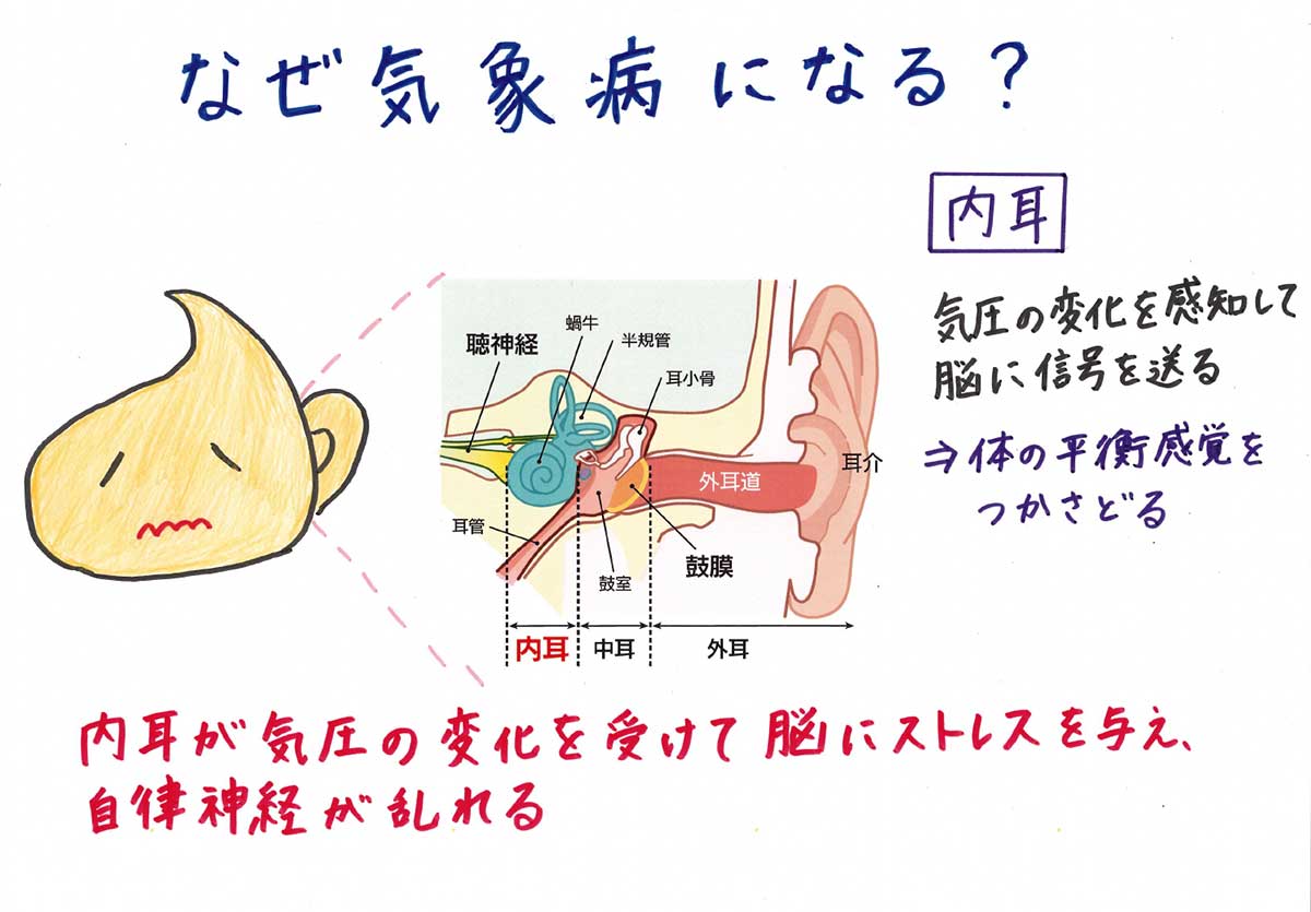 気象病